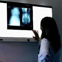 Ultrasound Jelly