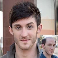 Toupee Hair