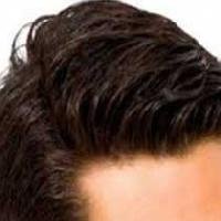 Hair Replacement Services