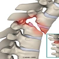 Fractures Treatment Service