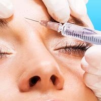 Botox Injection