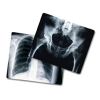 X-Ray Films in Ahmedabad