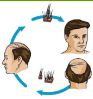 Hair Transplant Cosmetic Surgery