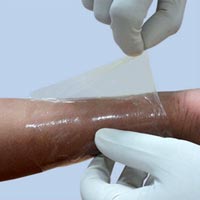 Healing Power of Collagen Wound Dressing: A Comprehensive Review