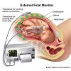 Fetal Heart Monitor