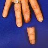 Artificial Fingers