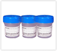 SAFECAN 30ml / 60ml Urine Container Sterile / Non Sterile