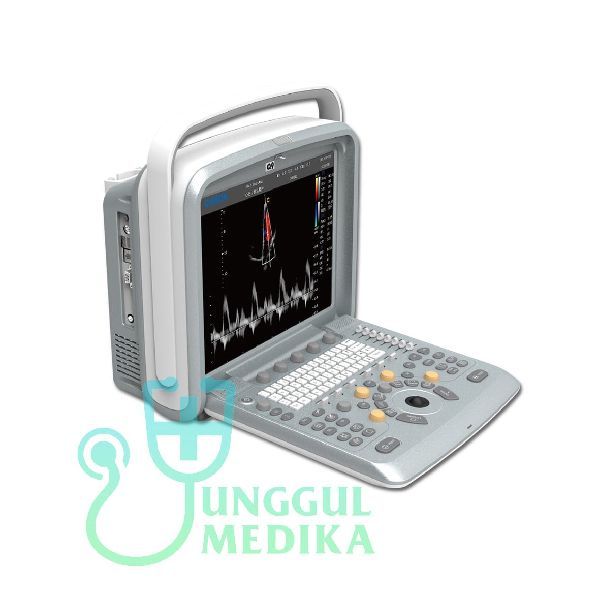 Chison Q9Vet Color Doppler Veterinary Ultrasound