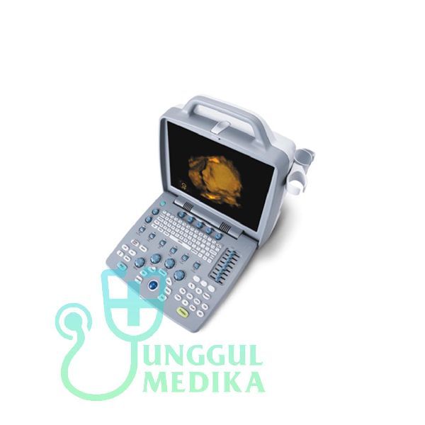 SIUI APOGEE 1200 OMNI Color Doppler Portable Ultrasound