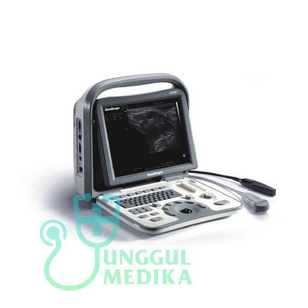 SonoScape A6V Veterinary Ultrasound