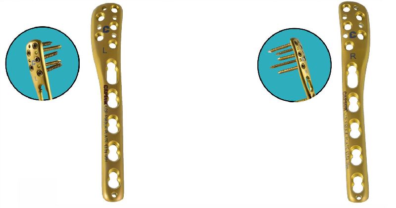 LCP Distal Fibula Plates, Certification : ISO, CE, FDA certification