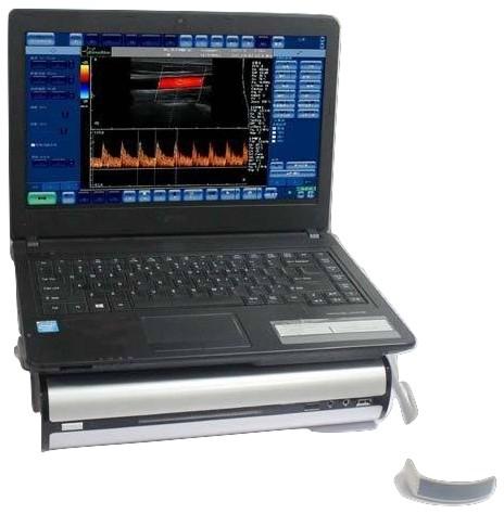 Digital Portable Color Doppler Ultrasound Scanner SIFULTRAS-6.5