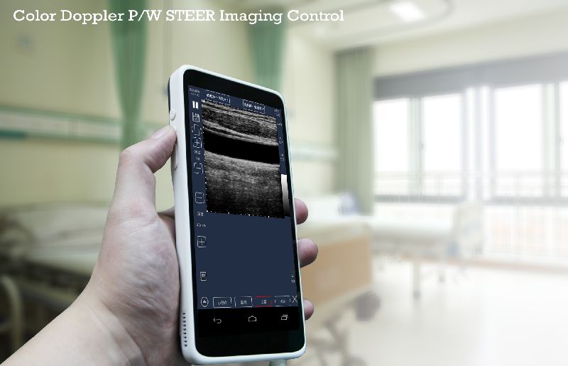 Handheld wired P/W STEER Color Doppler imaging Control Ultrasound Scanner , linear ,128 Element , 5-