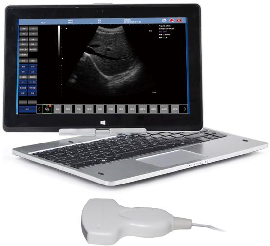 Laptop Ultrasound Scanner WiFi DICOM SIFULTRAS-9.1
