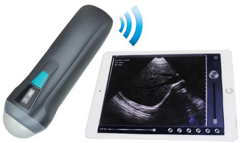 Sector Scan Ultrasound WiFi Probe SIFULTRAS-5.6