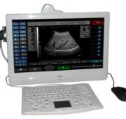 SIFULTRAS-4.1 Portable Wireless Pregnancy Ultrasound Scanner