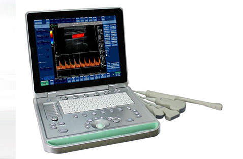 SIFULTRAS-6.1 Portable Color Doppler Pregnancy Ultrasound Scanner