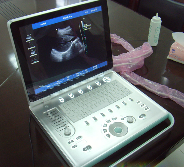 SIFULTRAS-6.2 Laptop Echocardiography Color Doppler Ultrasound Scanner