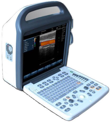 SIFULTRAS-6.3 Portable Color Doppler Vascular Ultrasound Scanner