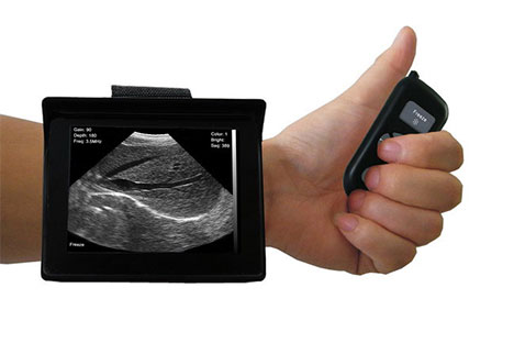 Veterinary Portable Wrist-Wear Ultrasound Scanner SIFULTRAS-4.3