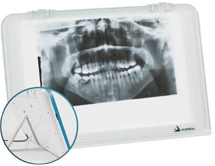 dental x ray film viewer