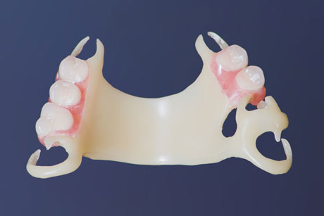 Flexible dentures