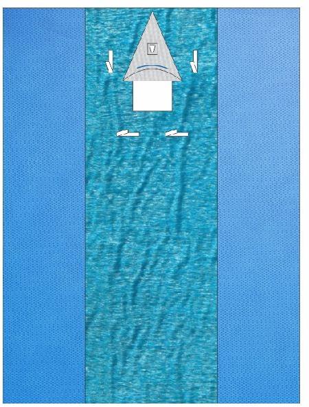 SURGICAL SHUNT DRAPE SHEET