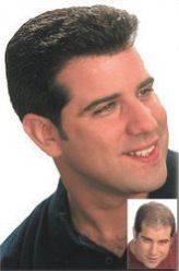 Men Hair Replacement Hair Piece System Toupees Manufacturer