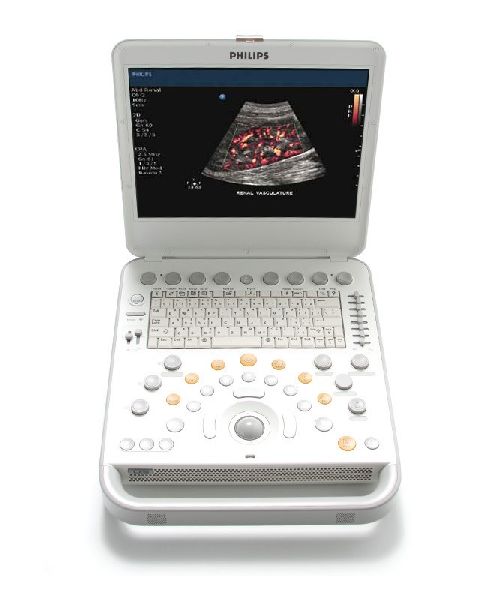 CompactXtreme ultrasound system