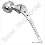 Bipolar Hip Prosthisis