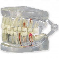 TOOTH UNIVERSAL MODEL