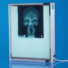 Electric Automatic X-Ray view screen, for Clinical, Home Purpose, Hospital, Voltage : 110V, 220V