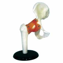 PVC Human Hip Joint Model, for Science Laboratory