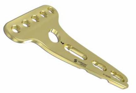 2.7mm LCP Buttress Head 5 Hole Plate