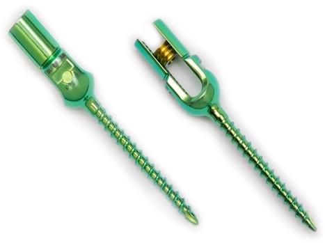 Pedicle Reduction Monoaxial Single Lock Screw, for Surgical Industry
