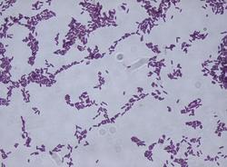 bacillus subtilis endospore stain