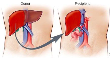 Liver Transplant Service