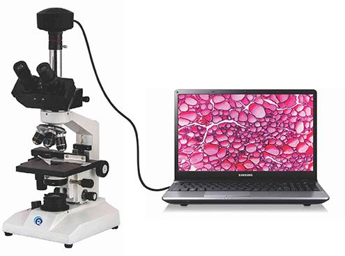 Radicon-Digital Trinocular Research Microscope ( Model RDM 56 )