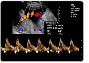 Services - Uterine Artery Doppler Scans from Zirakpur Punjab India by ...