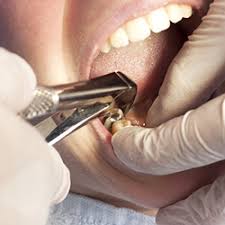 Oral Surgery Services