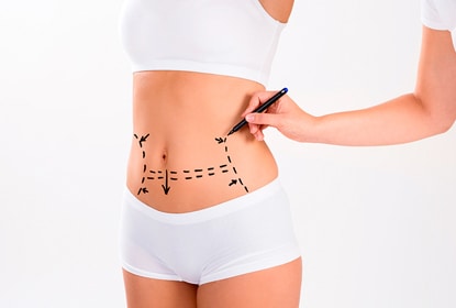 Tummy Tuck Surgery