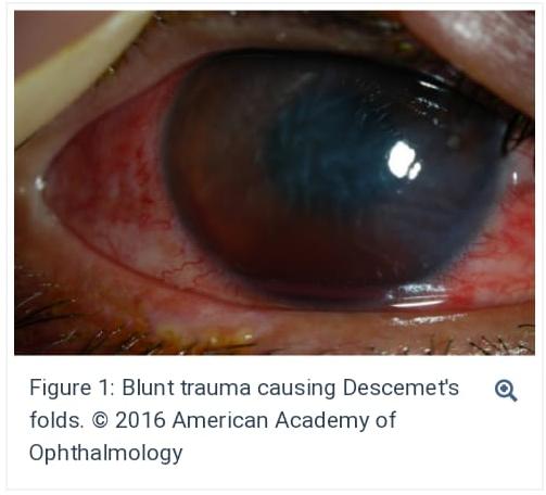 Ocular Trauma Services