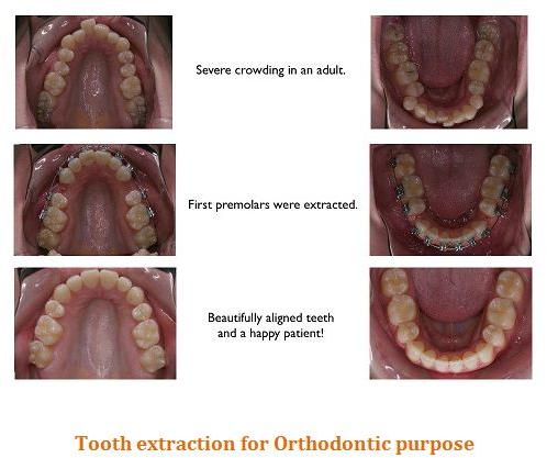 Orthodontic Surgery Treatment Services