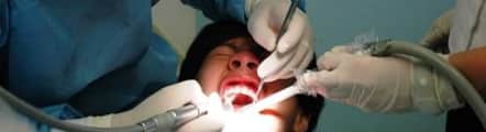 Oral Surgery Services