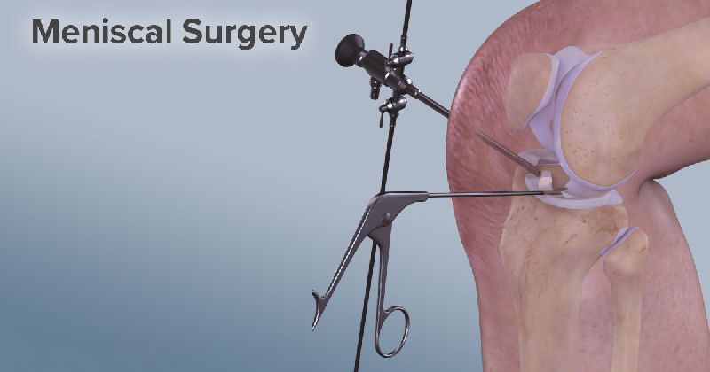 Meniscal Surgery