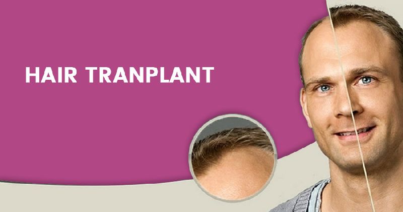 Best FUE Hair Transplant Surgeon In Gurgaon