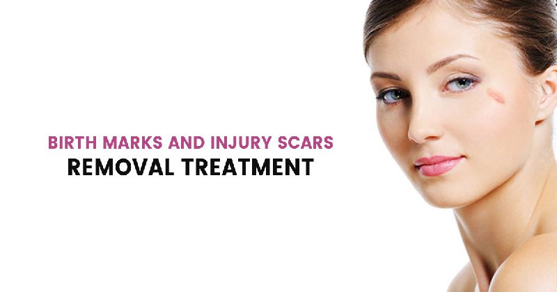 Birth Marks Removal Treatment in Gurgaon