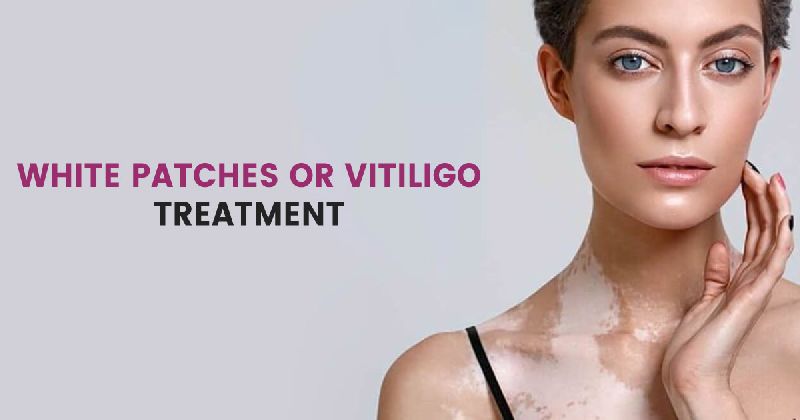 White Patches Treatment in Gurgaon