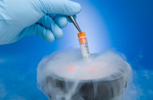 Frozen Embryo Replacement