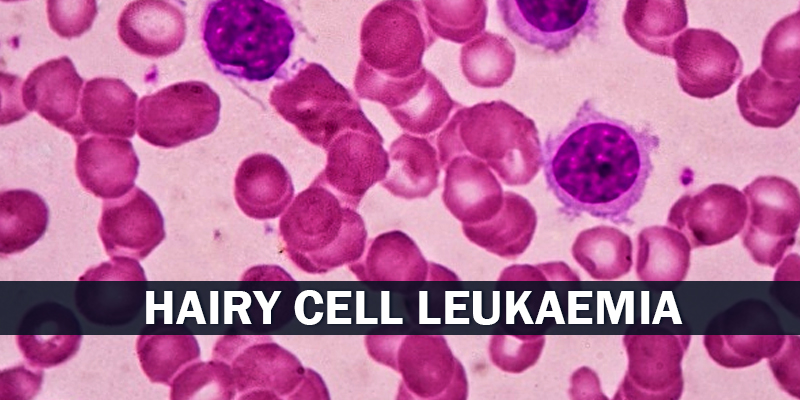 Hairy Cell Leukemia Treatment in India